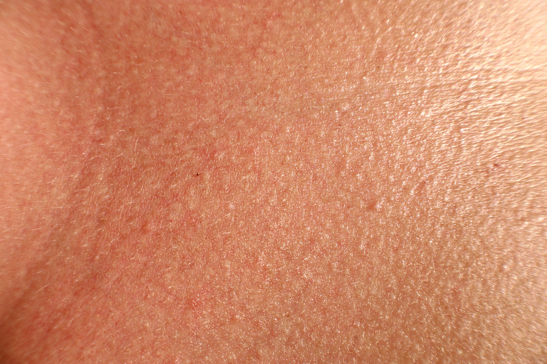 ekstra naha eemaldamine parast kaalulangust tervislikud taimetoidud kaal
